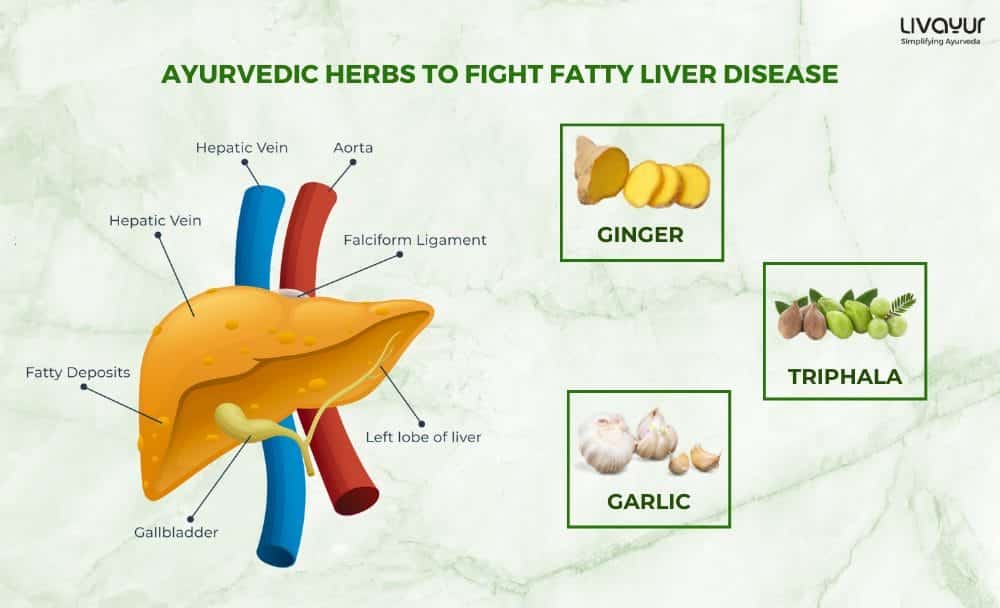 Fight Fatty Liver Disease With 5 Ayurvedic Herbs