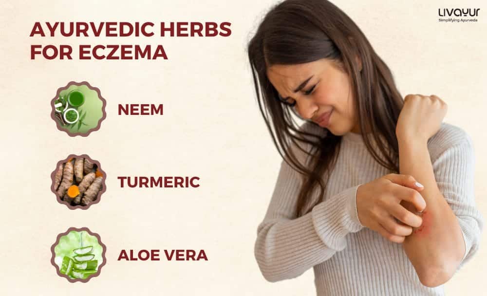 Ayurvedic Treatment of Eczema Tips and More